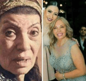 صور صادمة للفنانة رجاء بعد اجراء عمليات تجميل؟تفاصيل
