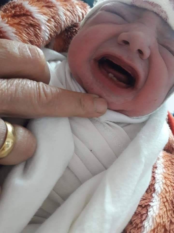 ولادة طفل يحمل سنين اثنين في فمه” في أربيل