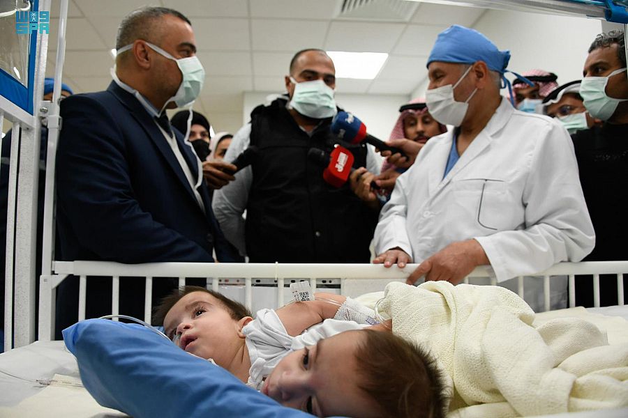 إنفاذًا لتوجيهات خادم الحرمين الشريفين الملك سلمان بن عبد العزيز آل سعود وسمو ولي عهده الأمين -حفظهما الله- بدء عملية فصل التوأم السيامي العراقي”علي وعمر”